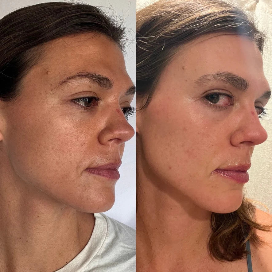 COLLAGEN CREAM MOISTURIZER