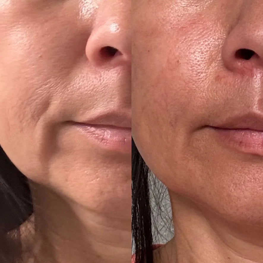 COLLAGEN CREAM MOISTURIZER