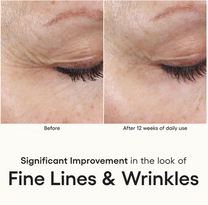 INTENSE SERUM