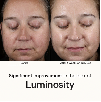 INTENSE SERUM